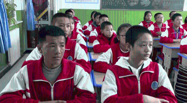 茶杯头